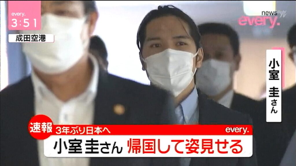 画像 小室圭おでこの傷や白斑は何 ヒアルロン酸やバセドウ病の噂 画像 小室圭おでこの傷や白斑は何 ヒアルロン酸やバセドウ病の噂